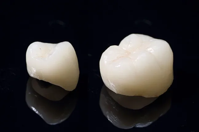ジルコニアセラミック(白い詰め物・被せ物)