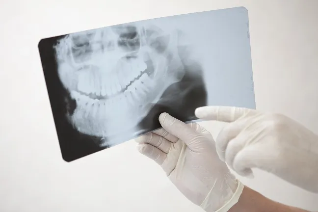 食習慣の変化などによって増えている病気です