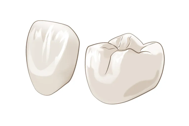 ジルコニアセラミック(白い詰め物・被せ物)