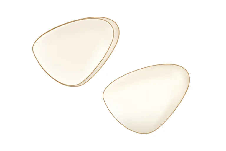 ラミネートべニア